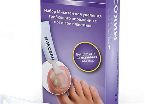 Химические средства для удаления грибкового ногтя