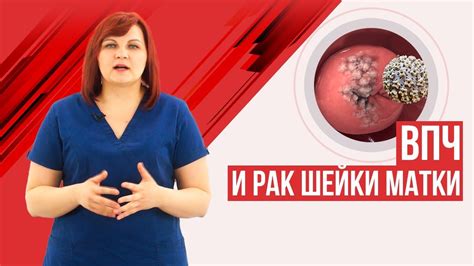 Хирургическое лечение ВПЧ 16: что нужно знать о операции
