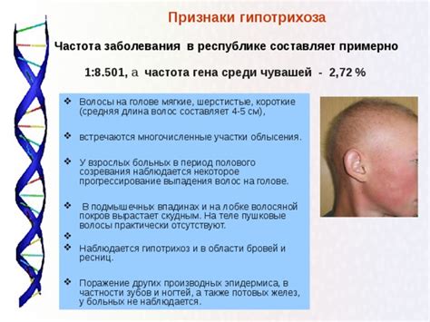 Частота заболевания среди взрослых