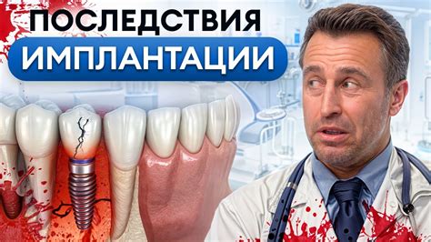 Частые причины поломки вытяжки: что может пойти не так