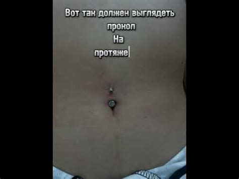 Чистка пупка: основные моменты