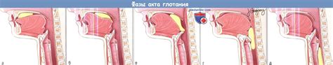 Что делать, если пища попала в дыхательные пути