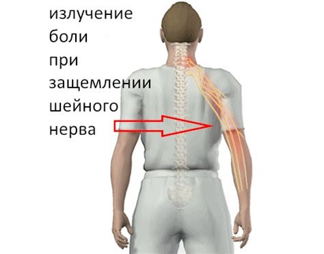Что делать при защемлении нерва между лопатками