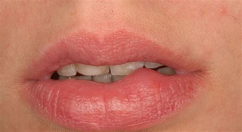 Что означает кусание нижней губы в разных ситуациях
