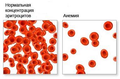 Что происходит при недостатке гемоглобина