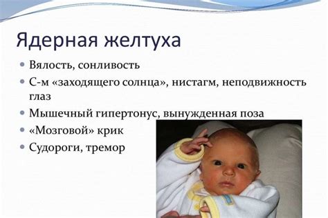Что такое желтушка у новорожденных