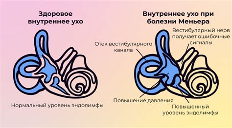 Что такое синдром логоса