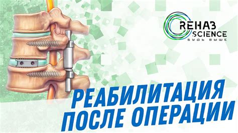 Этапы развития блокады в позвоночнике