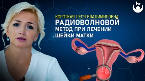 Эффективность применения утрожестана в лечении укорочения шейки матки