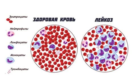 Эффект лечения