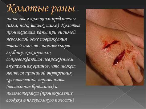  Влияние промывания раны водой на процесс заживления 