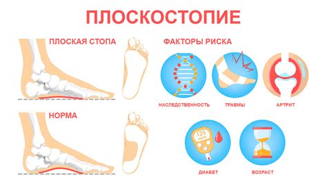  Влияние физкультуры на плоскостопие 