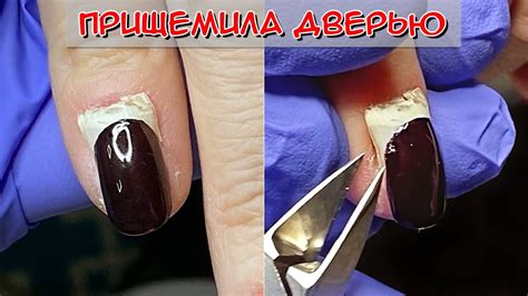  Предупреждение смятия пальца дверью на руке 