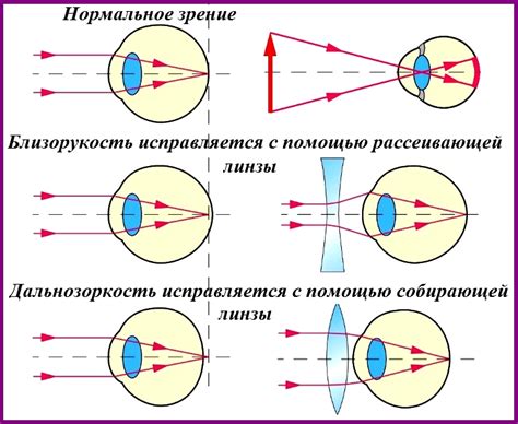  При возникновении проблем с линзами